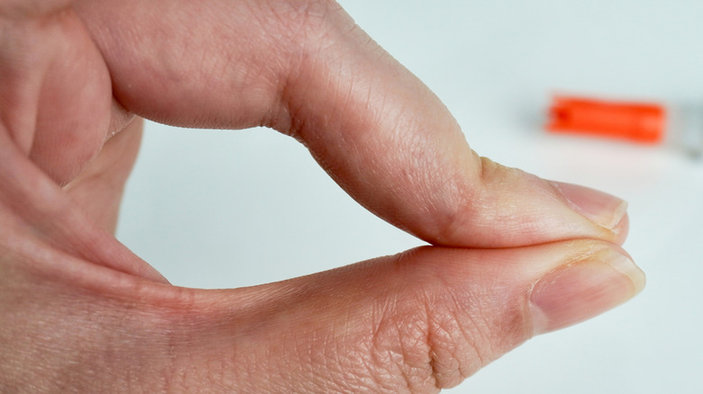 fingers stuck together with super glue in the background